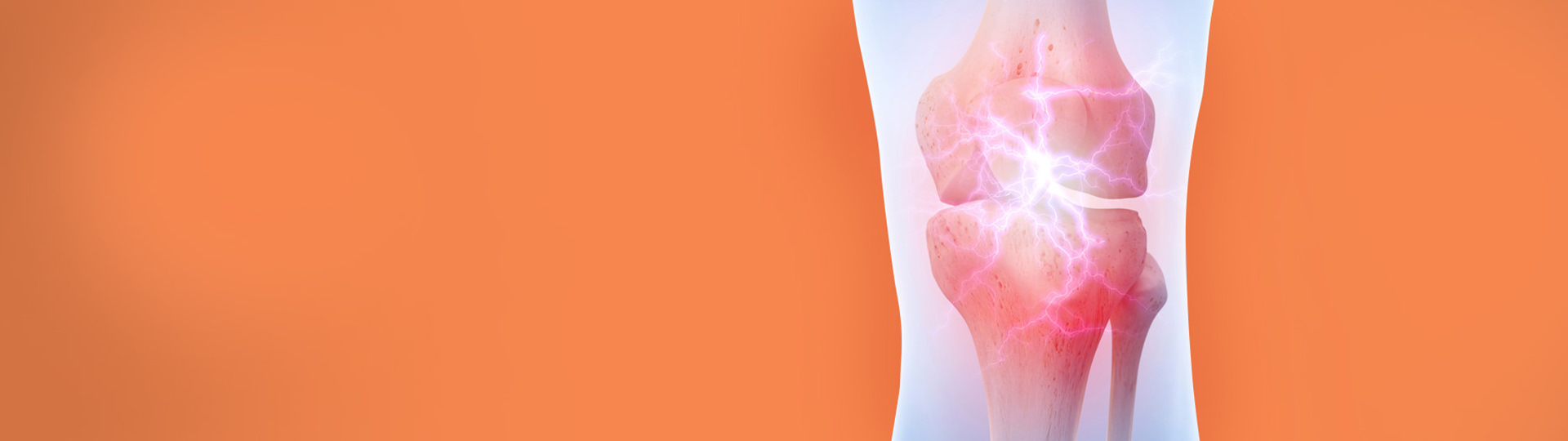 KOMBI BALÍČEK NA KLOUBY